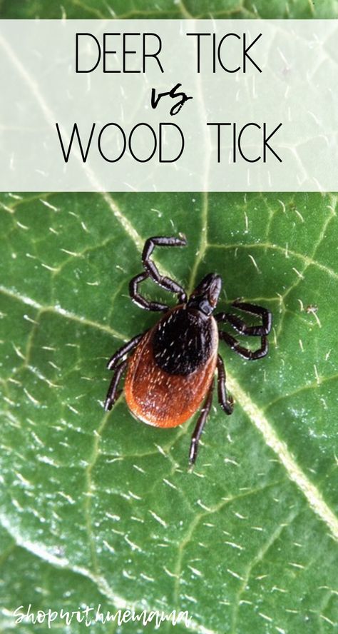 Deer Tick vs Wood Tick, what's the difference? #woodtick #ticks #deerticks #woodticks #health #wellness #tips Remove Ticks From Humans, Deer Tick Bite, Ticks On Humans, Wood Tick, Deer Ticks, Ticks On Dogs, Tick Removal, Tick Bite, American Dog