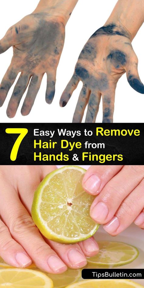 Find out how to get rid of a hair dye stain on your skin with lemon juice, olive oil, or rubbing alcohol. Permanent hair dye is hard to get off, but not impossible. Next time you use hair color, apply petroleum jelly to your hairline to prevent a dye stain. #remove #hair #dye #hands #fingers How To Get Rid Of Hair Dye On Skin, How To Get Hair Dye Out Of Skin, How To Remove Hair Dye From Skin, Remove Semi Permanent Hair Color, Diy Hair Dye Remover, Removing Black Hair Dye, Remove Permanent Hair Dye, Remove Hair Dye, Diy Hair Dye