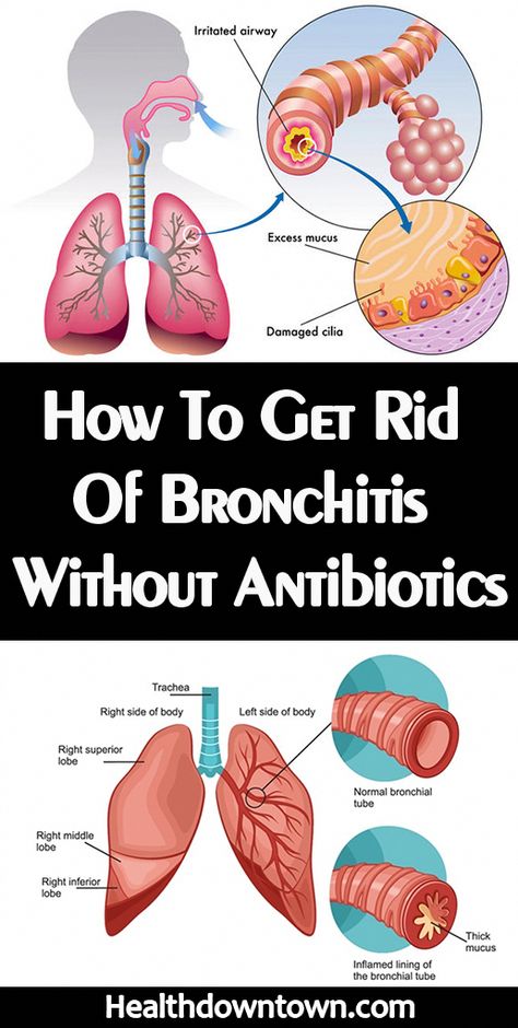 In this video, we unveil the top 10 home remedies to get rid of bronchitis without antibiotics. Say goodbye to bronchitis symptoms with these natural remedie... Remedies For Bronchitis, Clear Your Sinuses, Home Remedies For Bronchitis, Best Cough Remedy, Top 10 Home Remedies, Natural Sleep Remedies, Natural Antibiotics, Increase Energy, Natural Cold Remedies