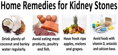 Home Remedies for Kidney Stones. ‪#‎KidneyStones‬ ‪#‎DrKammela‬ Kidney Stone Pain Relief, Kidney Cleanse Natural, Kidney Detox Cleanse, Whole Grain Foods, Kidney Pain, Kidney Detox, Cleanse Your Liver, Kidney Stone, Kidney Cleanse