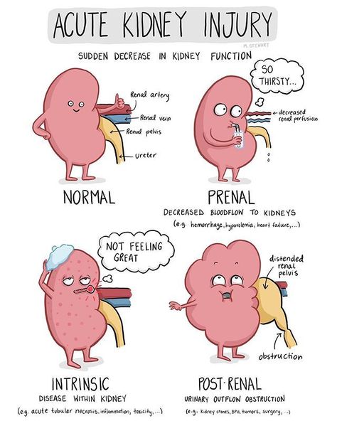 Todays podcast is out and gives a great overview of AKI #nursing #nursingstudents Acute Kidney Injury, Nursing School Essential, Nursing School Motivation, Nurse Study Notes, Nursing Mnemonics, Nursing Student Tips, Medical Student Study, Nursing School Survival, Medical School Motivation