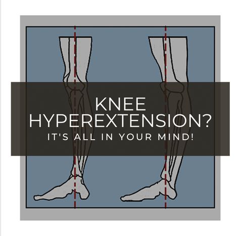 Knee Hyperextension Exercises, Knee Pain Stretches, Core Exercises For Women, Swollen Knee, Inner Knee Pain, Ligaments And Tendons, Knee Stretches, Knee Pain Relief, Knee Exercises