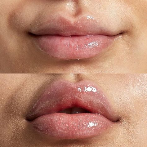 Diy Lip Plumper, Lip Plumper Device, Gel Ideas, Plump Lips Naturally, Natural Lip Plumper, Lip Gel, Eyebrow Makeup Tips, Face Wrinkles, Lip Injections