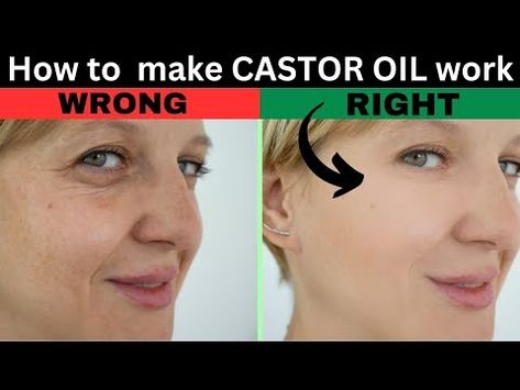 Castor Oil Benefits Skin, Skin Tightening Essential Oil, Face Wrinkles Remedies, Castor Oil For Face, Castor Oil Uses, Castor Oil For Skin, Castor Oil Benefits, Anti Wrinkle Skin Care, Natural Face Skin Care