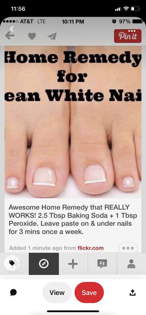 Nail Brushes, White Nails, Toe Nails, Nail Tips, Home Remedies, Baking Soda, You Nailed It, Baking, Nails