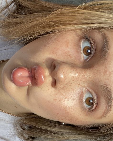 Sun Kissed Freckles, Blonde Hair Brown Eyes Freckles, Blonde Brown Eyes Girl, How To Get Freckles Naturally In The Sun, Freckles Across Nose, Freckle Inspiration, Cute Freckles Aesthetic, Freckle Placement, Blond With Brown Eyes