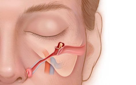 Eustachian Tube Dysfunction, Ear Congestion, Ear Tubes, Soft Palate, Acupressure Therapy, Basic Anatomy And Physiology, Middle Ear, Lymph Drainage, Human Body Anatomy