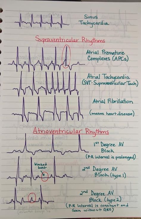 Vtne Study, Vet Tech Study Notes, Vtne Study Notes, Veterinarian Notes, Veterinary Nurse, Vet Tech Cheat Sheet Anesthesia, Vet Tech School Notes, Vet Assistant Notes, Vet School Notes