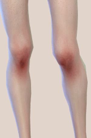 Sims 4 Knee Blush, Ts4 Blush Skin Detail, Ts4 Bandages, Sims 4 Cc Body Wounds, Sims 4 Cc Injuries, Sims 4 Cc Bruising, Sims 4 Bruising, Sims 4 Cc Scars Arm, Sims 4 Cc Blood Stains