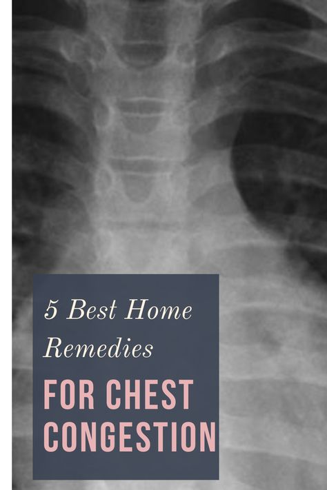 The following home remedies including OTC drug Ascoril have been found to provide fast and effective relief to most people suffering from chest congestion. Learn more. #homeremedies #chestcongestion #whattodowithchestcongestions #naturalremediesforchestcongestions #mamabee Home Remedy For Chest Congestion, Chest Congestion Remedies Lungs, Remedy For Chest Congestion, Chest Infection Remedies, Chest Congestion Relief, Remedies For Chest Congestion, Chest Congestion Remedies, Chest Infection, Congestion Relief