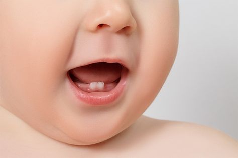 Teething Symptoms, Dental Kids, Pediatric Dentist, Pediatric Dentistry, First Tooth, Baby Teeth, Dental Clinic, Oral Hygiene, Dental Health