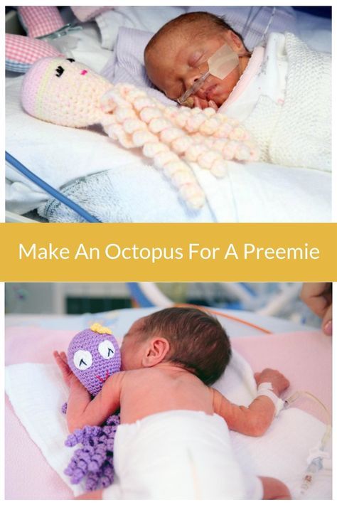 octopus for a preemie Octopus Knitting Pattern, Octopus Crochet Pattern Free, Octopus Knitting, Diy Laine, Preemie Octopus, Preemie Crochet, Simple Knitting, Octopus Crochet Pattern, Crocheted Jellyfish