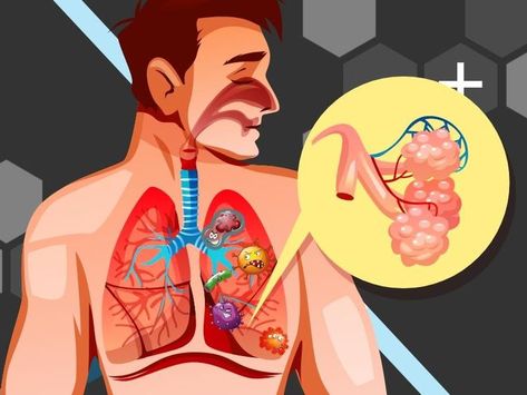 Respiratory Tract infections cover a wide variety of symptoms that brings discomfort to your ability to breathe. It can be something mild or can be a sign of something more severe. Failure to treat it quickly can cause other underlying conditions. https://www.facebook.com/rx2gopharmacy/posts/pfbid02GGzv9fA8aWka1nyXxgEa5dBf4cGMyN8eU3ZzRSkx2EARxmFkouuJCHUDSvSmhQqml #RTI #lungs #respiratorytractinfection #cough Health Podcast, Feminine Health, Respiratory Infection, School Of Medicine, Health Matters, Lungs, Health And Fitness Tips, Respiratory, A Sign