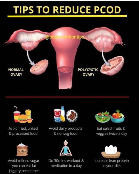 Hormone Nutrition, Fertility Health, Food Health Benefits, Healthy Hormones, Fertility Diet, Feminine Health, Women Health Care, Menstrual Health, Polycystic Ovaries