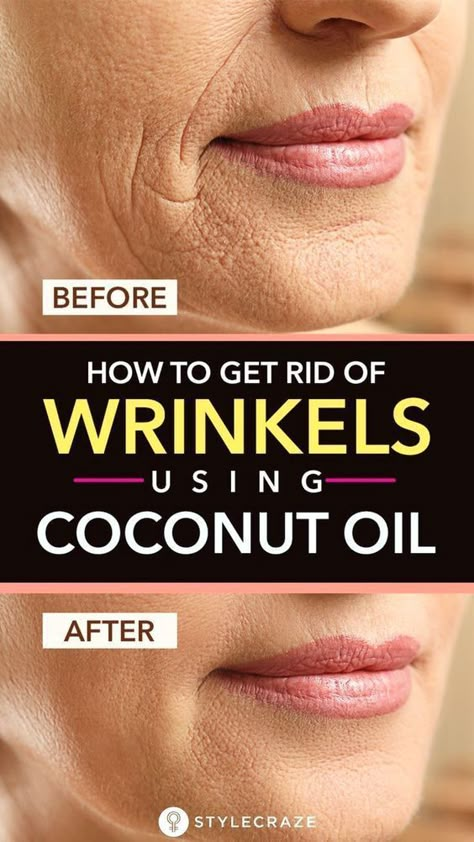 Wrinkles Remedies Face, Wrinkles Remedies, Get Rid Of Wrinkles, Skin Care Wrinkles, Baking Soda Shampoo, Beauty Tips For Face, Face Wrinkles, Anti Aging Skin, Natural Beauty Tips