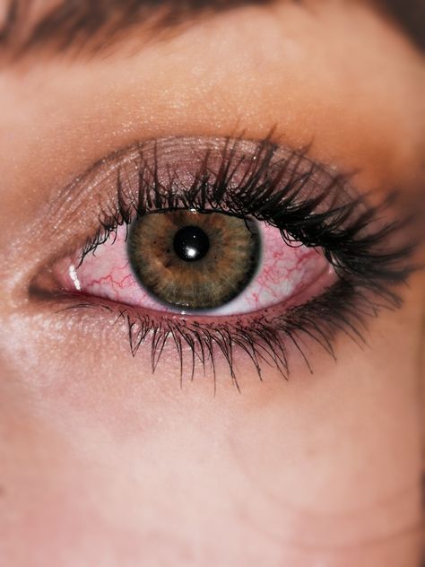 Alcoholic Eyes, Eye Veins, Blood Shot Eyes, Zombie Oc, Bloodshot Eyes, 17th Birthday Ideas, Red Veins, Eye Illustration, Eye Pictures