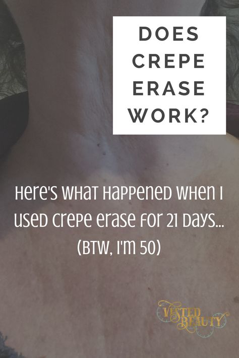 Thinking about buying Crepe Erase? Here's how it worked on my neck and decolletage after 21 days. Oh, and I'm 50 and have good genes. Also, how to save money on it! Men Anatomy, Haircut Mens, Crepe Skin, Crepe Erase, Creepy Skin, Hairstyles Mens, Prostate Health Men, Diets For Men, Aesthetic Men