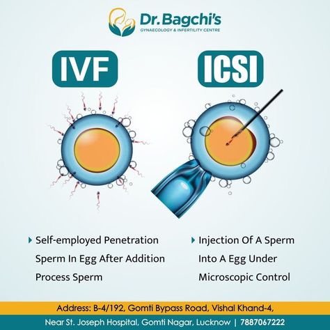 Fertilization Process, Anatomy Education, Fertility Help, Ivf Cost, Low Sperm Count, Ivf Clinic, Ivf Center, In Vitro Fertilization, Baby Center