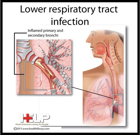 Lower Respiratory Tract Infection Lower Respiratory Tract, Marriage Photos, Respiratory System, Respiratory, Nursing, Education, Health, Quick Saves