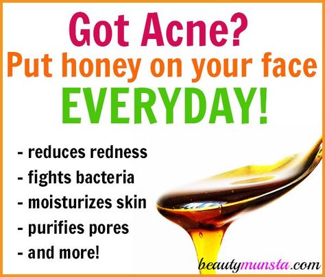 Learn how to use manuka honey for acne on your face everyday! Painful Pimple, Honey For Acne, Beauty Diy Skincare, Essential Oils For Skin, Good Healthy Snacks, Manuka Honey, Happy Skin, Beauty Hacks Video, Natural Health Remedies