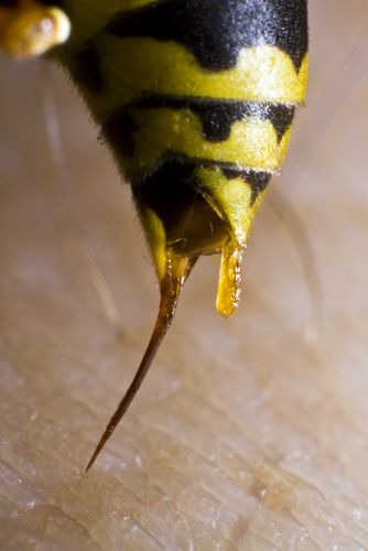 . Bee Sting Remedy, Yellow Jacket Bee, Wasp Sting, Arachnids Spiders, Book Witch, Wasp Stings, The Wicked Witch Of The West, I Love Bees, Wicked Witch Of The West