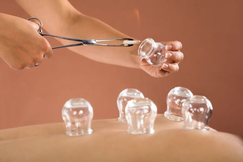 What Is Cupping Therapy, Wet Cupping, Honey Wrap, Fire Cupping, Bad Cough, Acupuncture Clinic, Cupping Therapy, Qi Gong, Body Detox