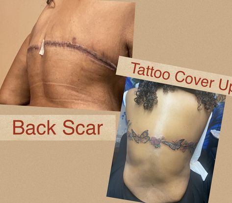 #tattoocoverup
#backscarhorror#butterfliesandroses Back Lift Scar Tattoo, Back Scar Tattoo Cover Up, Tattoo Scars Covering, Back Scar Tattoo, Arm Lift Scar Tattoo Cover Up, Scar Tattoos Women, Surgical Scar Tattoo, Tattoos Over Scars, Surgery Tattoo