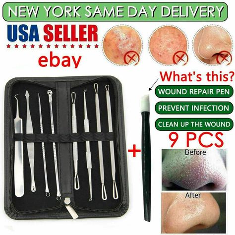 Using this remover tool is one of the safest ways to clear your pores, rather than squeezing blackheads using your fingernails. It will also lessen trauma to the surrounding skin. Type: Acne Extractor Set. Squeezing Blackheads, Acne Tool, Pimple Extractor, Removing Blackheads, Blind Pimple, Comedone Extractor, Pimples Under The Skin, Blackhead Remover Tool, Blackheads On Nose