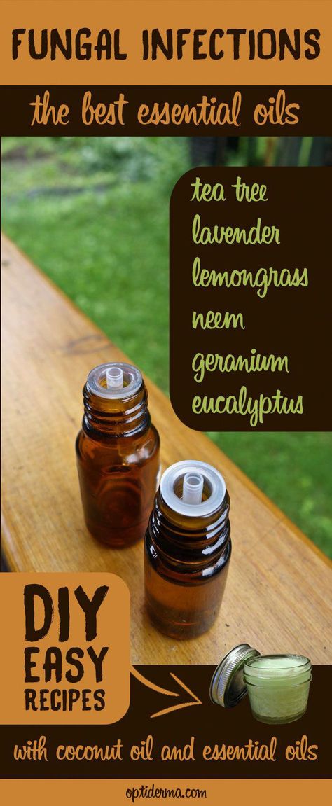 Helpful Essential Oil Fungus Techniques For bedroom designs Essential Oils For Fever, Antifungal Essential Oil, Get Rid Of Cold, Cold Sores, Essential Oil Remedy, Oil Remedies, Essential Oils Health, Cold Sores Remedies, Toenail Fungus