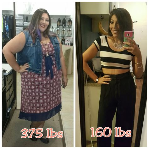 Before and After 215 lb weight loss! VSG Gastric Sleeve before and after. Anything is possible. Fitness Before And After Pictures, Motivation Pictures, Lose 30 Pounds, Pole Fitness, Body Fitness, Diet Keto, Lose 20 Pounds, After Photos, Fitness Transformation