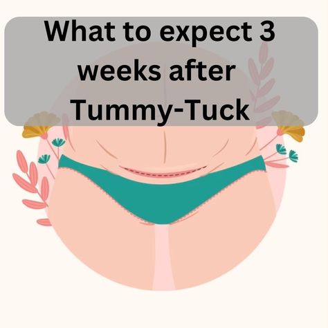 3 Weeks After Tummy Tuck, What to expect, Recovery & More | ClinicSpots Abdominalplasty Recovery, Plastic Surgery Recovery Tips, Tummy Tucks Post Op, Tummy Tucks Recovery List, Tummy Tucks Recovery Tips, Tummy Tucks Before And After, Mommy Makeover Surgery Recovery, Plastic Surgery Recovery, Tummy Tucks Recovery