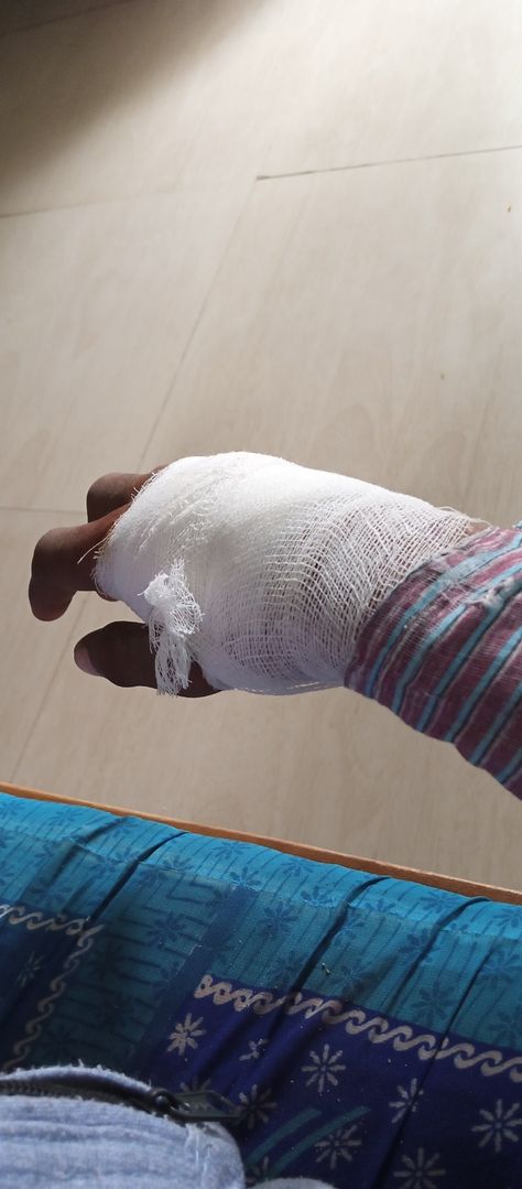 Fractured Hand Pic, Medicines Snapchat, Rakul Preet Singh Saree, St Bus, Attitude Bio, Hospital Admit, Radha Beauty, Attitude Bio For Instagram, Night Rides Snapchat