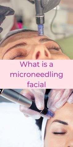 Micronidelling Face, Layers Of The Skin, Microneedling Pen, Spa Facials, Esthetician Business, Micro Needling, Facial Toning, Skin Advice, Beauty Clinic