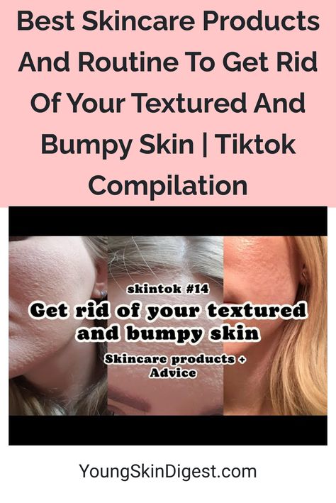 Best Skincare Products And Routine To Get Rid Of Your Textured And Bumpy Skin | Tiktok Compilation Bumpy Skin, Uneven Skin Texture, Best Skincare, Facial Cleansers, Best Skincare Products, Effective Skin Care Products, Best Moisturizer, Skin Care Remedies, Skin Care Solutions