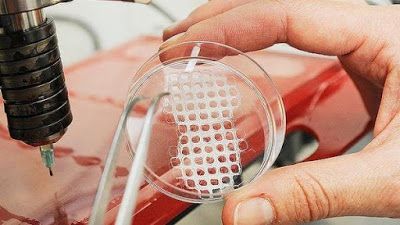 Tissue Engineering, Survey Report, Human Body Parts, Biomedical Engineering, Dental Surgery, Medical Devices, Dermal Fillers, Marketing Professional, Medical Device