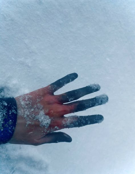 Frost bite on hand using alchol activated makeups. Ice On Face Aesthetic, Frostbitten Aesthetic, Frostbite Hands, Cold Hands Aesthetic, Frostbite Aesthetic, Freezing Aesthetic, Frost Bite Makeup, Frostbite Makeup, Frozen Photography