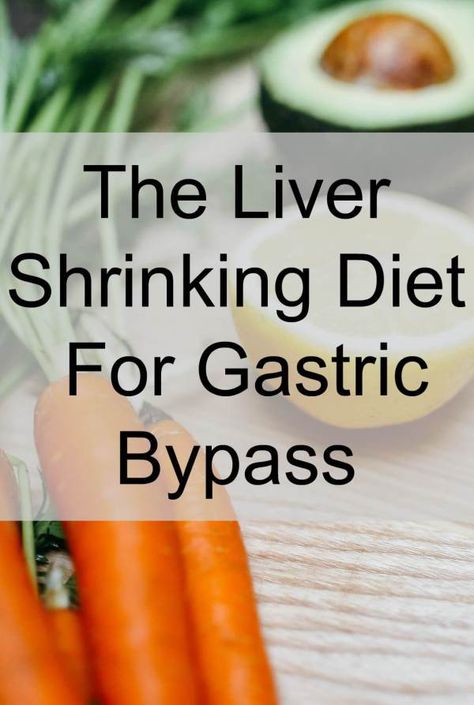 The Liver Shrinking Diet Liver Shrinking Diet, Sleeve Surgery Diet, Bariatric Recipes Sleeve Liquid Diet, Bariatric Recipes Sleeve, Gastric Bypass Diet, Gastric Bypass Recipes, Reduction Diet, Bariatric Friendly Recipes, Bariatric Diet