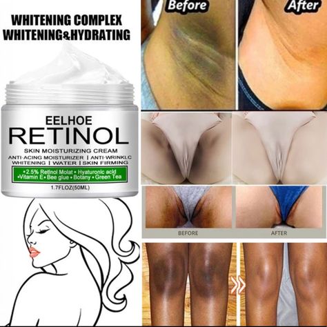 Private Parts Underarm Bleaching Serum Remove Melanin Pigmentation Brighten Inner Thigh Intimate Dark Best Of The Best !. Underarm Bleaching, Body Whitening Cream, Armpit Whitening, Body Whitening, Bleaching Cream, Skin Lightening Cream, Diy Skin Care Routine, Dark Spots On Skin, Lightening Creams