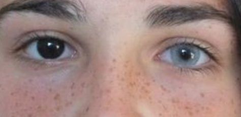 Heterochromia Eyes, Aesthetic Eyes, Pretty Eyes, Beautiful Eyes, Face Claims, Eye Color, Character Inspiration, Pretty People, Art Reference