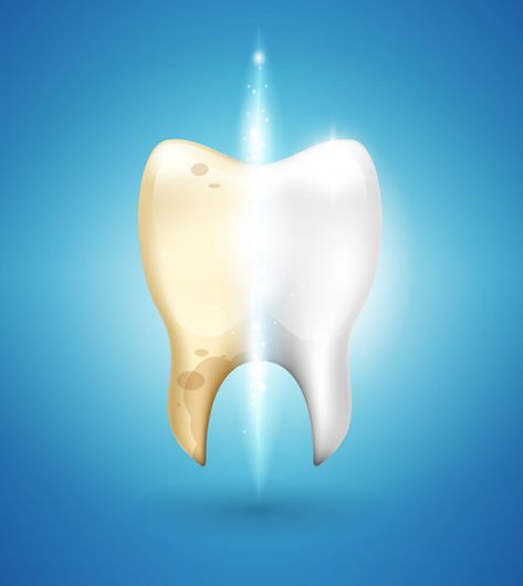 Tooth Whitening, Calculus, Brushing, In 3d, Premium Vector, Graphic Resources