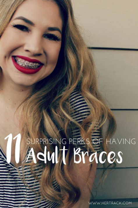 Considering adult braces? It may not be as bad as you think! Check out why. #braces #adultbraces #dental #bracesproblems Braces Advice, Braces Inspiration, Braces Problems, Braces Humor, Braces Girl, Braces Journey, Invisible Teeth Braces, Braces Before And After, Damon Braces