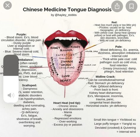 Qi Deficiency, Tcm Traditional Chinese Medicine, Ayurvedic Healing, Tongue Health, Acupressure Points, Victoria Bc, Traditional Chinese Medicine, Alternative Health, Chinese Medicine