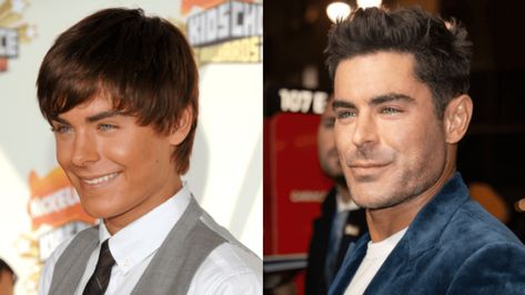 Zac Efron Face Before & After Jaw Surgery Plastic Surgery Gone Wrong, Jaw Surgery, Face Reading, Fashion Newsletter, Celebrity Plastic Surgery, The Kardashians, Jackie O, Zac Efron, What Really Happened