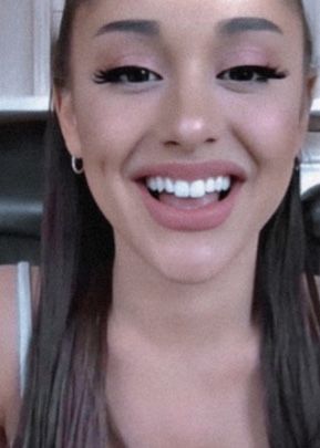 Ariana Grande Teeth, Bunny Teeth Smile Girl, Bunny Teeth Smile, Ariana Grande Bunny, Bunny Teeth, Hollywood Smile, Teeth Whitening Homemade, Ariana Grande Sweetener, Laura Marano