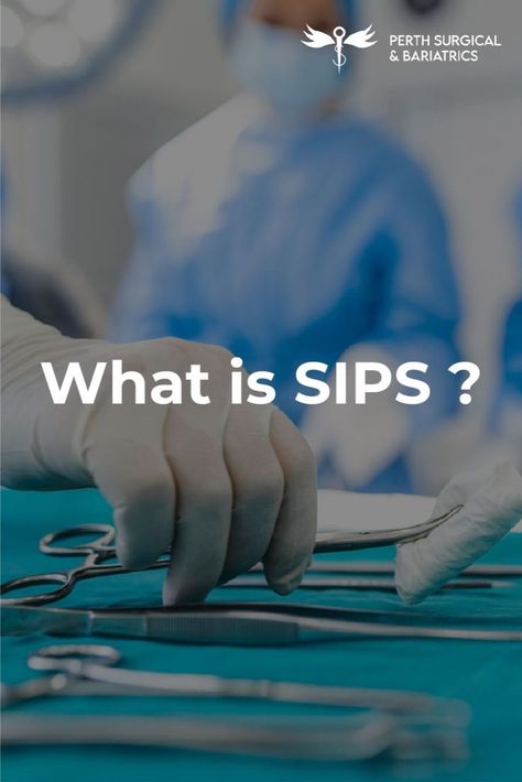 Stomach Intestinal Pylorus-Sparing Surgery (SIPS) is a surgical weight loss procedure. This process combines the benefit of a gastric sleeve and gastric bypass. To aid in weight loss, SIPS shrinks your stomach and skips a portion of the digestive process. SIPS operation results in higher weight loss than conventional gastric bypass and sleeve gastrectomy. Reach out to the PSB team to know more about how this surgery can benefit you. Book an appointment online or call us on 08-6558-1901. Sleeve Gastrectomy, Digestion Process, Gastric Bypass, Perth Western Australia, Book An Appointment, Support Group, Height And Weight, Take Care Of Yourself, Success Stories