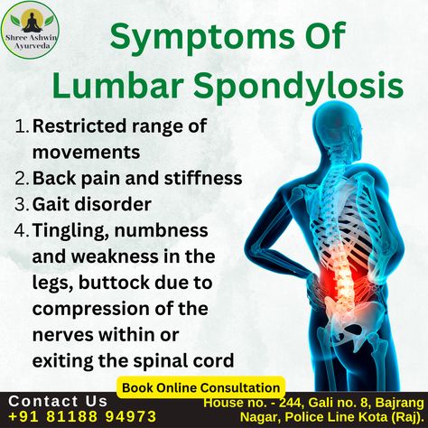 Lumbar Spondylosis Contact Us Shree Ashwin Ayurveda call : +91 81188 94973 website : www.shreeashwinayurveda.com #ShreeAshwinAyurveda #ayurvedic #ayurvedicmedicine #ayurvedic_medicine #naturalmedicine #herbalmedicine #traditionalmedicine #medicine #solutions #ayuvedicday #jointpaincause Lumbar Spondylosis, Therapy Notes, Spinal Cord, Traditional Medicine, Ayurvedic Medicine, Natural Medicine, Herbal Medicine, Nerve, Physical Therapy