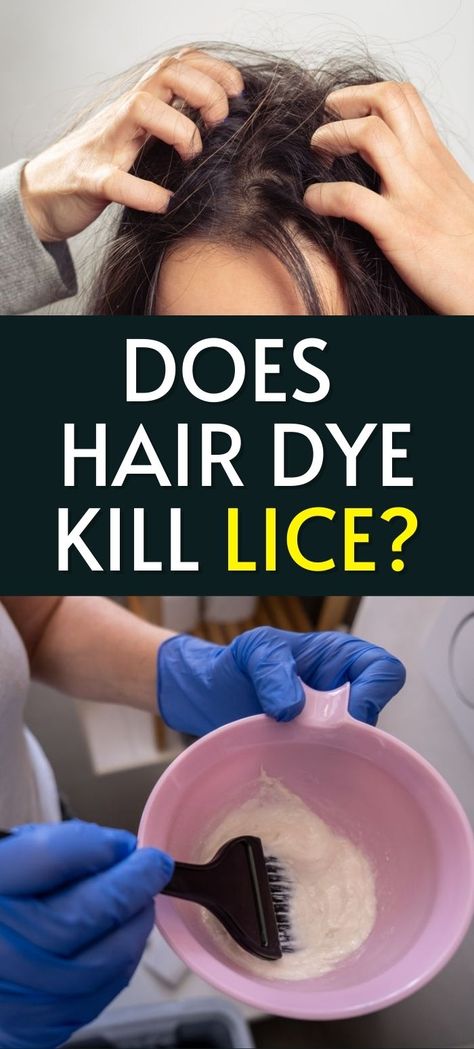 Does Hair Dye Kill Lice? How to Get Rid of Lice Using Hair Color How To Get Rid Of Lice, How To Get Rid Of Lice Fast, Lice Remedies How To Get Rid Of, Lice Remedies, Box Hair Dye, Hair Lice, Diy Hair Dye, Lice Removal, Clean Hairbrush