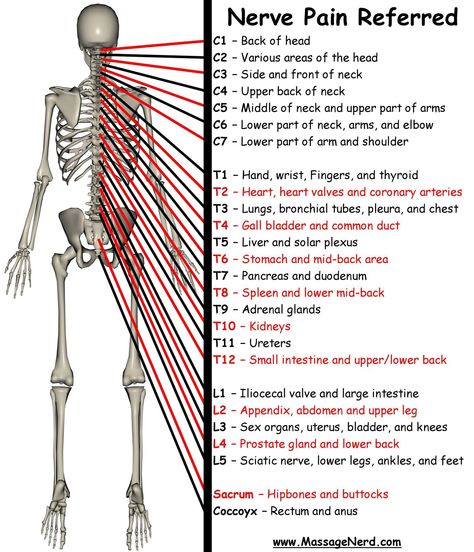 Nerve pain----- Massage Pictures, Referred Pain, Spine Health, Nerve Pain Relief, The Nervous System, Nerve Pain, Anatomy And Physiology, The Human Body, Acupressure