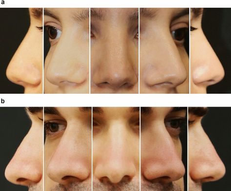 Nose All Angles, Flat Nose Reference, Face Anatomy Tips, Covering Ears Reference, 360 Face Reference, Nose Reference Angles, Roman Nose Front View, Noses Different Angles, Nose 3/4 View