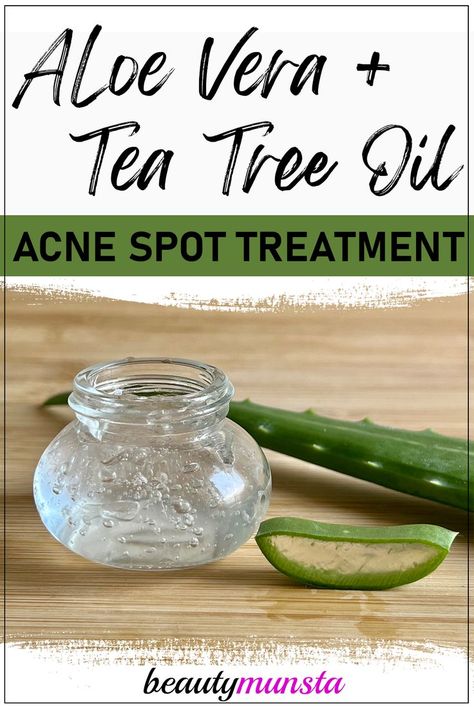 For acne and pimples, use this DIY acne remedy with aloe vera gel and tea tree oil. Aloe vera is cooling and healing for acne. It reduces redness and inflammation, calming down acne flares. Tea tree oil is highly anti-bacterial and is a great natural way of getting rid of acne or pimples. Acne Remedy, Carrier Oils For Skin, Tea Tree For Acne, Blind Pimple, Tea Tree Oil For Acne, Pimples Under The Skin, Pimples Remedies, Acne Gel, Diy Acne